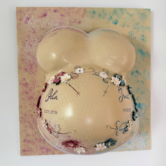 Babybauch Gipsabdruck Magdeburg